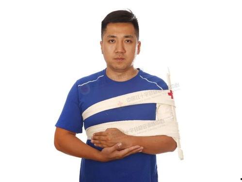 上臂骨折固定视频,上臂骨折固定操作步骤详解